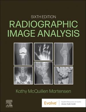 Image of Radiographic Image Analysis